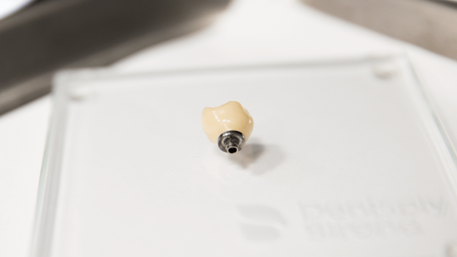 A picture of a crown implant