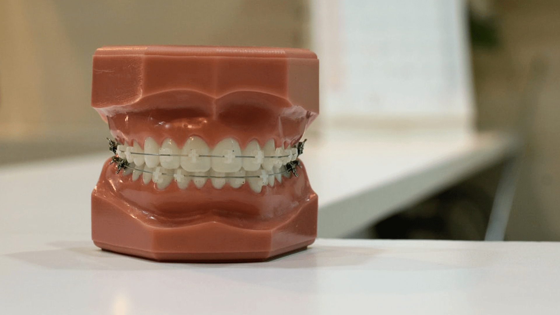 A mold of a human mouth with teeth
